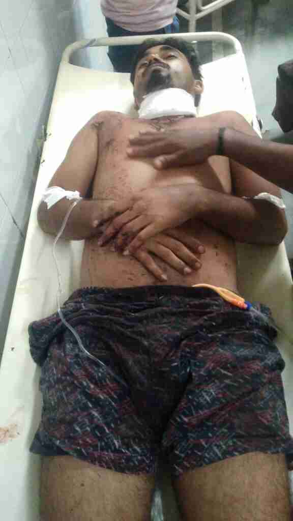 सोते हुए दूकानदार पर प्राण घातक हमला 1 WhatsApp Image 2023 08 13 at 18.58.54