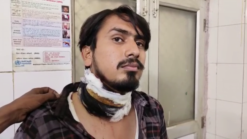 गोंडा में ठेले वाले ने दुकानदार पर किया चाकू से हमला, जिला अस्पताल में कराया गया भर्ती 1 Untitled design 6