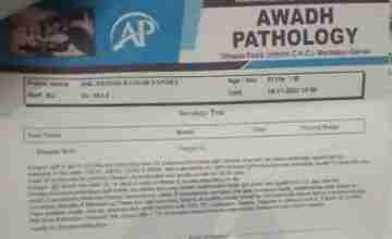 गोंडा में डेंगू जांच के नाम पर लूट, अवैध पैथलॉजी वाले कर रहे 1500 रुपए की वसूली 2 WhatsApp Image 2023 11 17 at 17.21.57 b5bc6fc2
