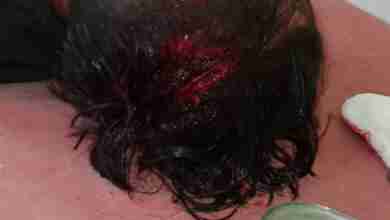 दबंगों ने मां बेटों को चाकू से मारकर किया घायल, सिर व हाथ पर आई गंभीर चोटें 2 WhatsApp Image 2023 12 07 at 17.01.12 cc20051b