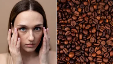 5s18249k dark circles 625x300 24 May 25