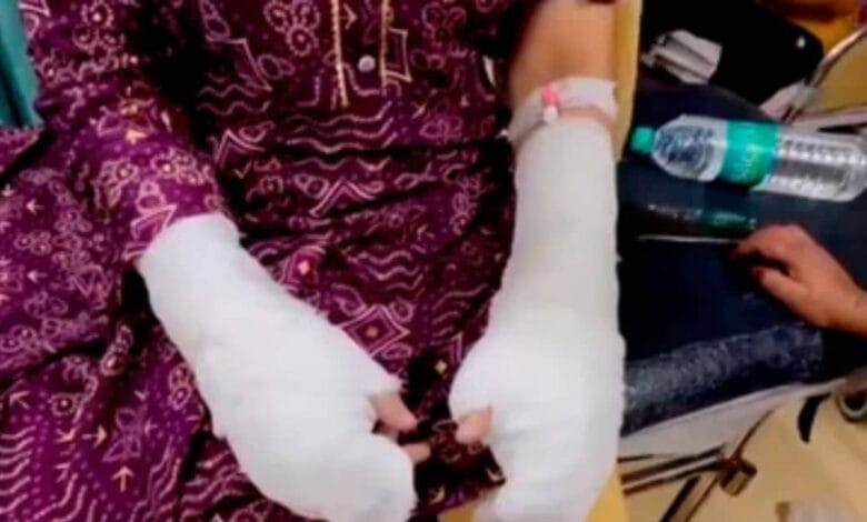 दिल्ली एसिड अटैक केस में बड़ा खुलासा: पीड़िता के पिता ने रची साजिश, पुलिस जांच में सामने आए चौंकाने वाले तथ्य 1 delhi case