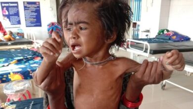 Dhar Malnutrition: धार में 25 हजार बच्चे कुपोषित, 5 हजार से ज्यादा SAM श्रेणी में; पोषण व्यवस्था पर उठे सवाल 4 orig 251670862246639755a658303img 20221209 wa0021 1670881229
